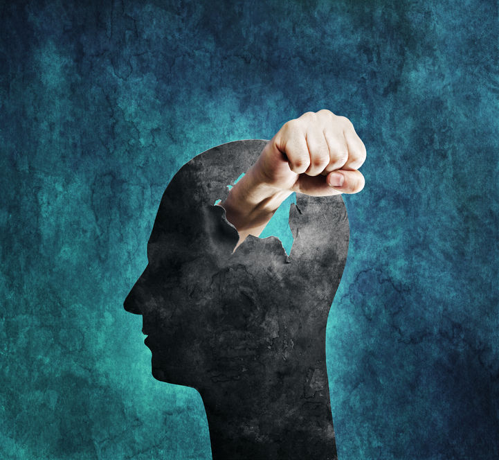 Postconcussion Syndrome